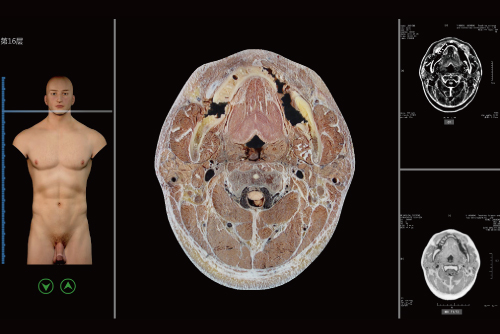 ���ӽ����c����Ӱ��̓�M�̌Wϵ�y(t��ng)